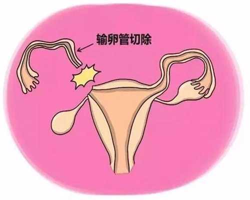 深圳试管婴儿胚胎移植后便秘是怎么回事？可以改善吗？